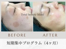 トータルビューティー マインド(Total Beauty)の雰囲気（【シミケアプログラム＊全国最優秀賞受賞】）