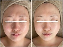 メイン(main)/★before after★