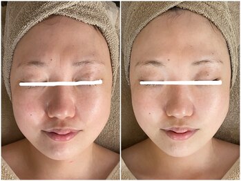 メイン(main)/★before after★