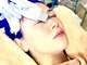 ミエリア美容鍼灸院(mielia美容鍼灸院)の写真/ここでしか受けられない！お悩みに合わせたあなた専用の肌質改善プログラム！手厚いサポート付き♪