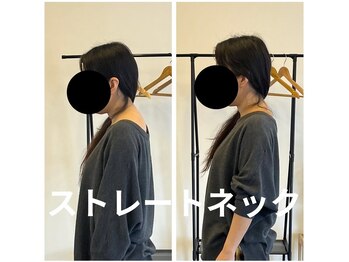 カワル整体 長嶺院/ストレートネック