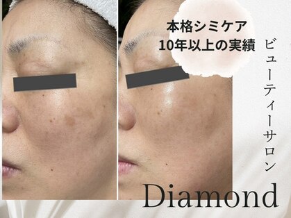 ダイヤモンド(Diamond)の写真