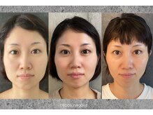 名古屋の美容激戦区にて　    口コミランキング１位、２位獲得!