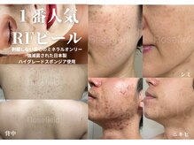 ローズフィールド(Rosefield)