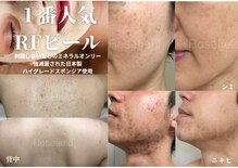 ローズフィールド(Rosefield)