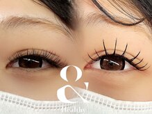 フィネス(Finesse)の雰囲気（アンドヘルシーでぱっちりお目元に）