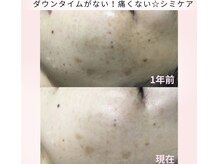 フルーヴ ルフレ(Fleuve Reflet)の雰囲気（夏でも出来るシミケア♪）