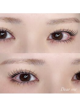 ディアミー(Dear me)の写真/つくば【完全個室×高技術】万博公園駅徒歩1分にNEWOPEN★マンツーマン施術でゆったり癒し時間を、、♪