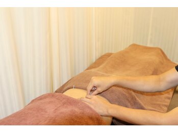 メディックス 広島西 こい本町鍼灸整骨院(MEDIX)の写真/国家資格保持者が施術!自律神経の乱れを整え、梅雨の頭痛や不調をケア♪