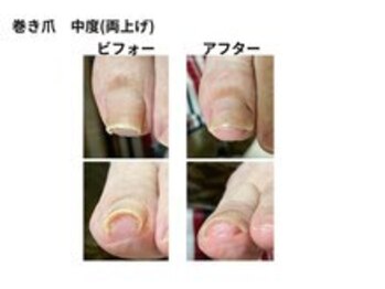 巻き爪補整店 桜庵の写真/巻き爪・見た目のお悩みまで!健康で美しい爪へ導く専門サロン