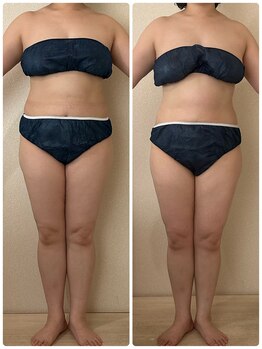 リノ(Lino)/30代初回→3回目