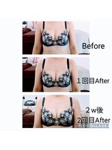 グランミオラ(Gran Miola)/バストケアbefore/after