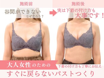 ベルフルール/バストアップ/熊本/南熊本