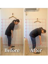 フォレスト(forrest)/腰痛の施術