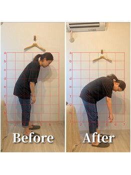 フォレスト(forrest)/腰痛の施術