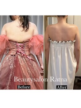 ラトナ(Ratna)/6回ブライダル痩身