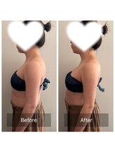 ラディアンス/たった30分で効果絶大☆