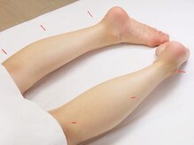 ルチア(Lucia)/鍼灸　首肩こり腰痛