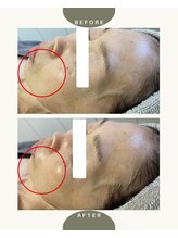 ルルーディア(LOULOUDIA)/シワ改善エイジングケア◎