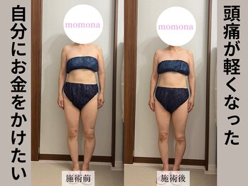 モモナ(Momona)/#肩こり#リンパマッサージ#野並