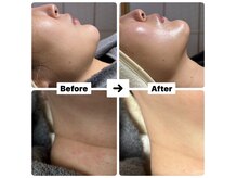 バイオ スキン プラス(Bio Skin Plus)