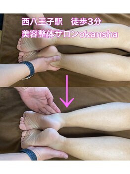 美容整体サロン オオカンシャ(okansha)/一度の施術のBefore→After