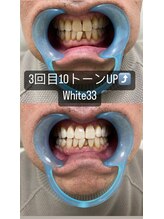 アイブロウ33/ホワイトニング　