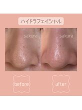 ビューティブロス(Beauty Bros)/