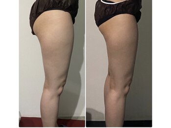 OBS/美脚痩身プログラム