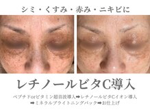 エクラ イオンモール徳島店(ECLAT)/超音波導入+イオン導入