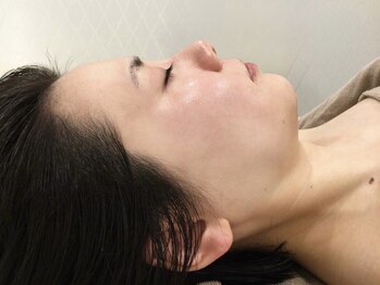セクレ 名駅店の写真/【水素水ミスト+高濃度気体水素タッピング+水素吸入】で毛穴洗浄+むくみ/つまり/脂肪分解で小顔効果絶大♪