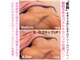 ドリームバスト 中崎町(Dream Bust)の写真