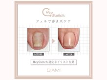 エム ネイル(M nail)の雰囲気（『HeySwitch』塗るだけ♪おすすめ！巻爪にお悩みの方専用ケア☆）