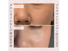 トリニティスペース(TrinitySpace)の雰囲気（さっしーおすすめの話題のサーモン成分PDRN。感動の肌に虜です☆）
