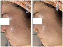 アロマ&クレイケアルーム ネロリドール(Nerolidol)の雰囲気（乾燥、敏感肌、肌荒れに◎）