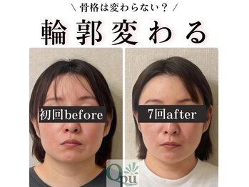 キュープ 高崎店(Qpu)/小顔頭蓋骨矯正＋リンパケア