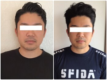 美容整体ウェリナ 中川八田院/小顔矯正/骨盤矯正/痩身整体