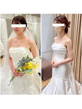 トータルボディケア サニー(TOTAL BODY CARE)/ブライダルエステbefore after