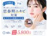 【U18限定】◆思春期ニキビ対策◆炭酸パック×プラズマ殺菌コース 5800円