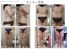 【北九州初！本気痩身】3STEPボディ120分￥17600
