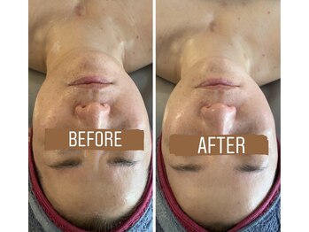 小顔コルギサロン シー(She)/【コルギ】1度の変化!