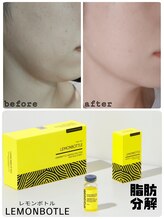 【レモンボトル】オーガニック脂肪分解剤