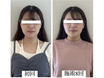 ラボーテヴェリテ(La Beaute Verite)/【お客様施術例】