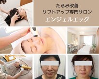 エンジェルエッグ