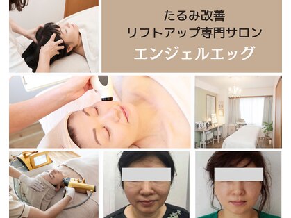 エンジェルエッグの写真