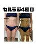 【贅肉撃退!お試し用】セルラジ体験（全身初回）¥9800