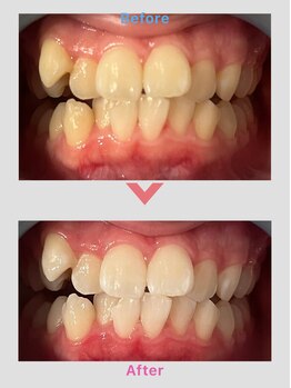 コトリト(Cotorito)/美容ホワイトニング