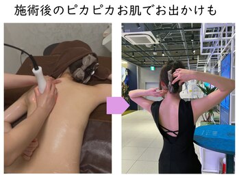 ブリス 渋谷駅前(BliSS)/お気に入りの服が似合う背中に♪