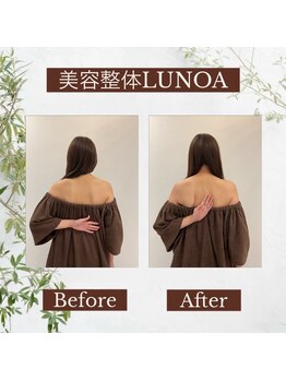 美容整体LUNOA　神戸三宮院/[三ノ宮/美容整体/整体/肩こり]