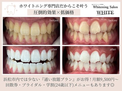 ホワイト(WHITE)の写真